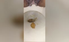 Shitting in toilet in close up